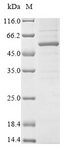 CHRDL1 Protein - (Tris-Glycine gel) Discontinuous SDS-PAGE (reduced) with 5% enrichment gel and 15% separation gel.