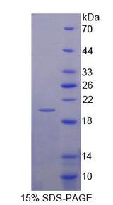 CHRDL2 Protein - Recombinant  Chordin Like Protein 2 By SDS-PAGE