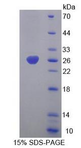 CHRNA4 / NACHR Protein - Recombinant Cholinergic Receptor, Nicotinic, Alpha 4 By SDS-PAGE