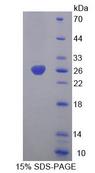 CHRNA4 / NACHR Protein - Recombinant Cholinergic Receptor, Nicotinic, Alpha 4 By SDS-PAGE