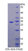 CITED1 Protein - Recombinant  Cbp/p300 Interacting Transactivator, With Glu/Asp Rich Carboxy Terminal Domain 1 By SDS-PAGE