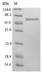 CKAP4 Protein - (Tris-Glycine gel) Discontinuous SDS-PAGE (reduced) with 5% enrichment gel and 15% separation gel.