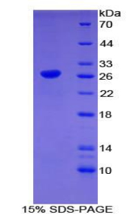 CLEC10A / CD301 Protein - Recombinant C-Type Lectin Domain Family 10, Member A By SDS-PAGE