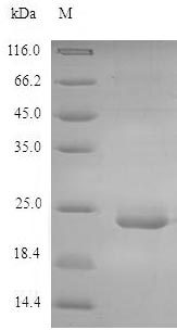 CLEC4E / MINCLE Protein - (Tris-Glycine gel) Discontinuous SDS-PAGE (reduced) with 5% enrichment gel and 15% separation gel.