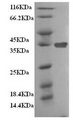 CLTA / LCA Protein - (Tris-Glycine gel) Discontinuous SDS-PAGE (reduced) with 5% enrichment gel and 15% separation gel.