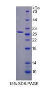 CLTA / LCA Protein - Recombinant Clathrin, Light Polypeptide A (CLTA) by SDS-PAGE