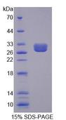 CML / BCR Protein - Recombinant Breakpoint Cluster Region (BCR) by SDS-PAGE