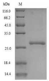 CMPK / CMPK1 Protein - (Tris-Glycine gel) Discontinuous SDS-PAGE (reduced) with 5% enrichment gel and 15% separation gel.