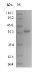 CMPK / CMPK1 Protein - (Tris-Glycine gel) Discontinuous SDS-PAGE (reduced) with 5% enrichment gel and 15% separation gel.