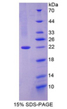 CNTF Protein - Recombinant Ciliary Neurotrophic Factor By SDS-PAGE