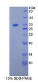 COL1A1 / Collagen I Alpha 1 Protein - Recombinant Collagen Type I Alpha 1 By SDS-PAGE