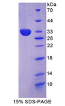 COL1A2 / Collagen I Alpha 2 Protein - Recombinant Collagen Type I Alpha 2 By SDS-PAGE