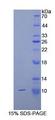 COL2A1 / Collagen II Alpha 1 Protein - Recombinant Collagen Type II Alpha 1 By SDS-PAGE
