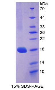 COL3A1 / Collagen III Protein - Recombinant Collagen Type III Alpha 1 By SDS-PAGE