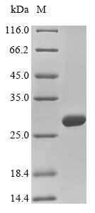 COL4A2 / Collagen IV Alpha2 Protein - (Tris-Glycine gel) Discontinuous SDS-PAGE (reduced) with 5% enrichment gel and 15% separation gel.