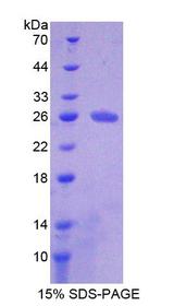 COL6A3 / Collagen VI Alpha 3 Protein - Recombinant  Collagen Type VI Alpha 3 By SDS-PAGE