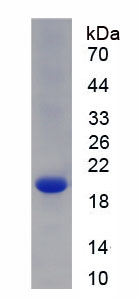 COL8A2 / Collagen VIII Protein - Recombinant Collagen Type VIII Alpha 2 By SDS-PAGE