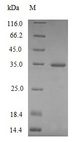 Complement C1QA Protein - (Tris-Glycine gel) Discontinuous SDS-PAGE (reduced) with 5% enrichment gel and 15% separation gel.