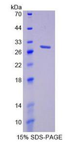 Complement C1QA Protein - Recombinant Complement Component 1, Q Subcomponent A By SDS-PAGE