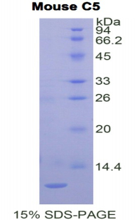 Complement C5 Protein - Recombinant Complement Component 5 (C5) by SDS-PAGE