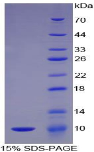Complement C5a Protein - Recombinant Complement Component 5a By SDS-PAGE