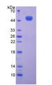 Complement C9 Protein - Recombinant  Complement Component 9 By SDS-PAGE