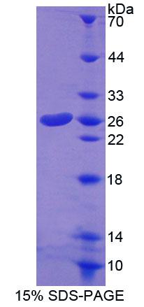 COT / CROT Protein - Recombinant Carnitine-O-Octanoyltransferase By SDS-PAGE