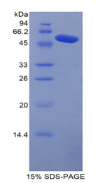 CPN1 Protein - Recombinant Carboxypeptidase N1 By SDS-PAGE