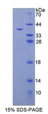 CPPED1 Protein - Recombinant Calcineurin Like Phosphoesterase Domain Containing Protein 1 (CPPED1) by SDS-PAGE