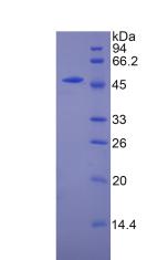 CPT1A Protein - Recombinant Carnitine Palmitoyltransferase 1A, Liver By SDS-PAGE