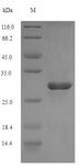 CR2 / CD21 Protein - (Tris-Glycine gel) Discontinuous SDS-PAGE (reduced) with 5% enrichment gel and 15% separation gel.