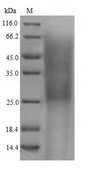 CR2 / CD21 Protein - (Tris-Glycine gel) Discontinuous SDS-PAGE (reduced) with 5% enrichment gel and 15% separation gel.
