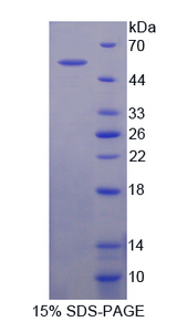 CRAT Protein - Recombinant  Carnitine Acetyltransferase By SDS-PAGE