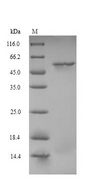 CRBN / Cereblon Protein - (Tris-Glycine gel) Discontinuous SDS-PAGE (reduced) with 5% enrichment gel and 15% separation gel.