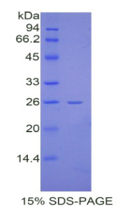 CREBBP / CREB Binding Protein Protein - Recombinant CREB Binding Protein By SDS-PAGE