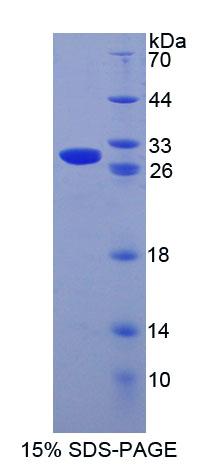 CRISP1 Protein - Recombinant Cysteine Rich Secretory Protein 1 By SDS-PAGE