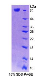 CRTAP Protein - Recombinant Cartilage Associated Protein By SDS-PAGE