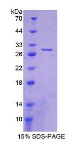 CRYBA1 Protein - Recombinant  Crystallin Beta A1 By SDS-PAGE