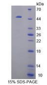CRYBB1 Protein - Recombinant  Crystallin Beta B1 By SDS-PAGE