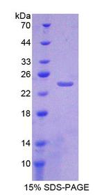 CRYGS Protein - Recombinant  Crystallin Gamma S By SDS-PAGE