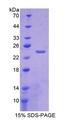CRYGS Protein - Recombinant  Crystallin Gamma S By SDS-PAGE