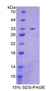 CS / Citrate Synthase Protein - Recombinant Citrate Synthase By SDS-PAGE