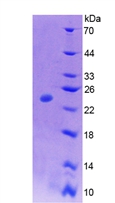 CSF1 / MCSF Protein - Active Colony Stimulating Factor 1, Macrophage (MCSF) by SDS-PAGE