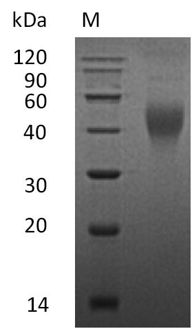 CSF1 / MCSF Protein - (Tris-Glycine gel) Discontinuous SDS-PAGE (reduced) with 5% enrichment gel and 15% separation gel.