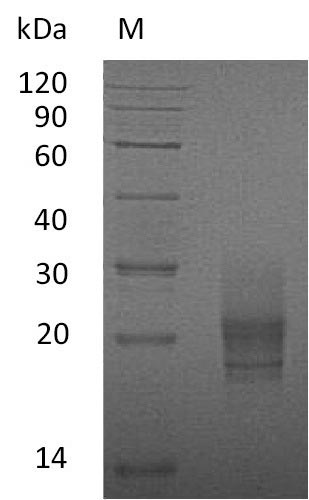 CSF2 / GM-CSF Protein - (Tris-Glycine gel) Discontinuous SDS-PAGE (reduced) with 5% enrichment gel and 15% separation gel.