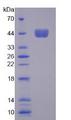 CSF2 / GM-CSF Protein - Active Colony Stimulating Factor 2, Granulocyte Macrophage (GMCSF) by SDS-PAGE