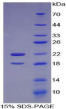 CSF2RA / CD116 Protein - Recombinant Colony Stimulating Factor 2 Receptor Alpha By SDS-PAGE
