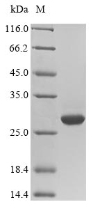 CSH1 / Placental Lactogen Protein - (Tris-Glycine gel) Discontinuous SDS-PAGE (reduced) with 5% enrichment gel and 15% separation gel.