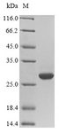CSH1 / Placental Lactogen Protein - (Tris-Glycine gel) Discontinuous SDS-PAGE (reduced) with 5% enrichment gel and 15% separation gel.