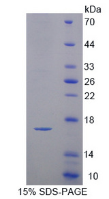 CST3 / Cystatin C Protein - Recombinant  Cystatin 3 By SDS-PAGE